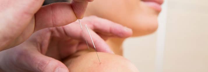 Chiropractic Mandan ND Acupuncture Chiropractic Mandan ND Acupuncture